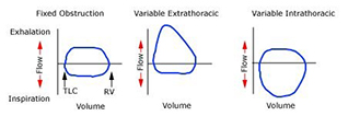 curvaflujovolumenmorfologia